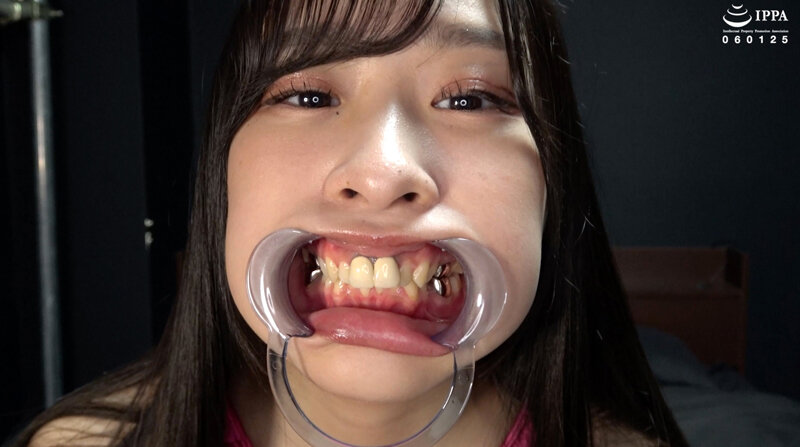 【歯＆口腔】人気女優 朝比ゆのチャンの歯＆口腔＆のどちんこ観察と小魚舐め！ サンプル 4