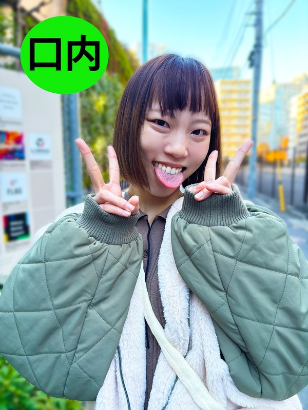 街角で声をかけて口内観察させてもらう オーガニックスーパー勤務 はつみちゃん