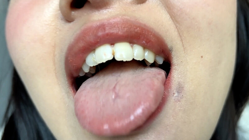 街角で声をかけて口内観察させてもらう コールセンターアルバイト あむちゃん サンプル 8