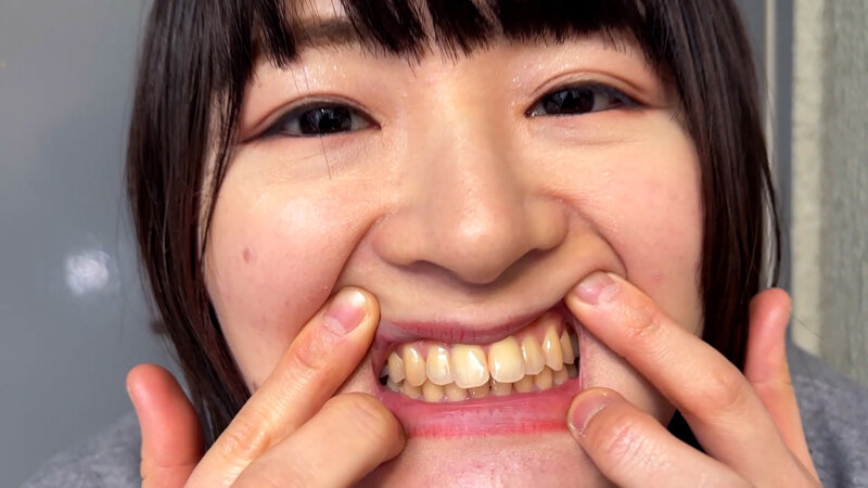 街角で声をかけて口内観察させてもらう 飲食店アルバイト みこちゃん サンプル 11