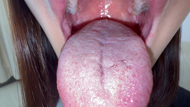 【個人撮影】旭メイサの舌ブラシで「汚舌苔」採取 サンプル 5
