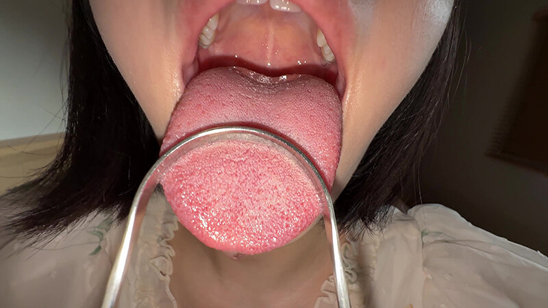 【個人撮影】大園明歩の舌ブラシで「汚舌苔」採取